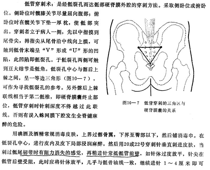 学会骶管阻滞—治疗疼痛性疾病